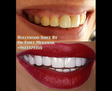 dentist lebanon beirut