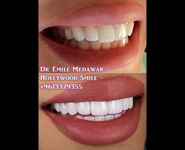 best dentist lebanon