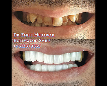 dental clinic lebanon