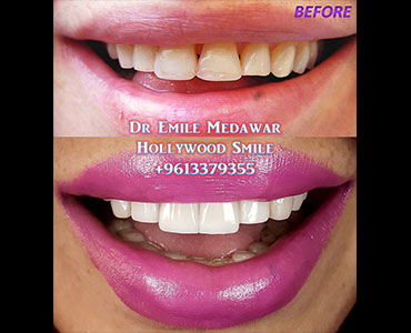 تجميل لبنان