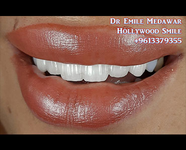 dentist lebanon beirut