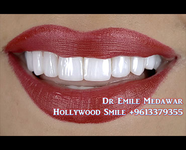 dental clinic lebanon