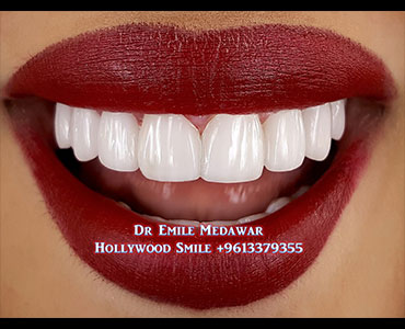 cosmetic dentist lebanon
