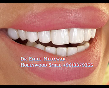 طبيب اسنان لبنان